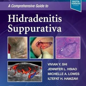 A Comprehensive Guide to Hidradenitis Suppurativa - eBook